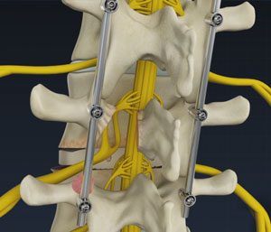 Spine