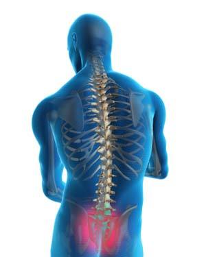 Sacroiliac Joint Dysfunction