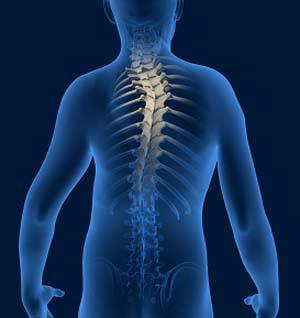 spine-deformity